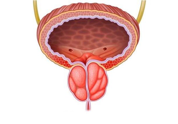 erkeklerde prostatit tedavisi